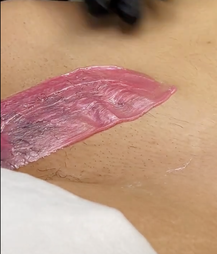 How to Prepare for a Brazilian Wax