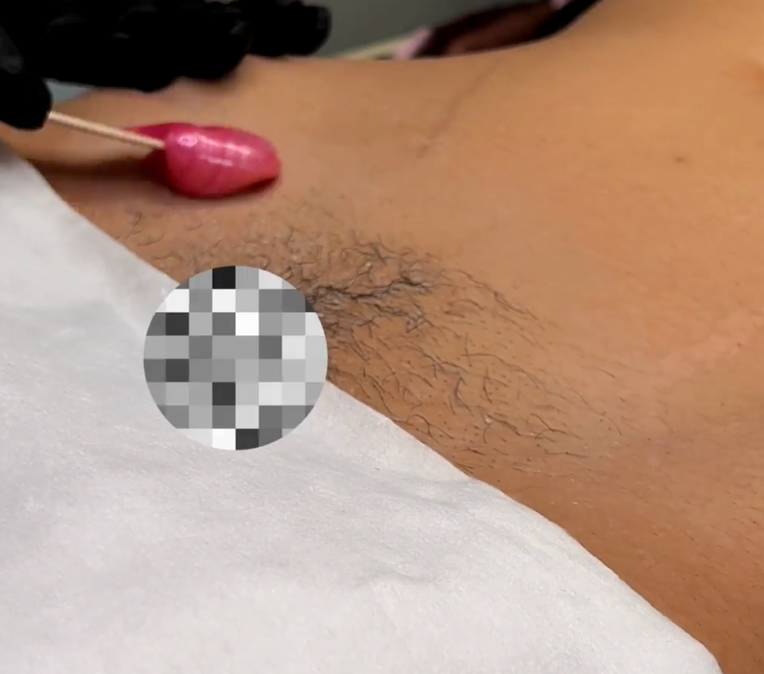 sex after bikini wax