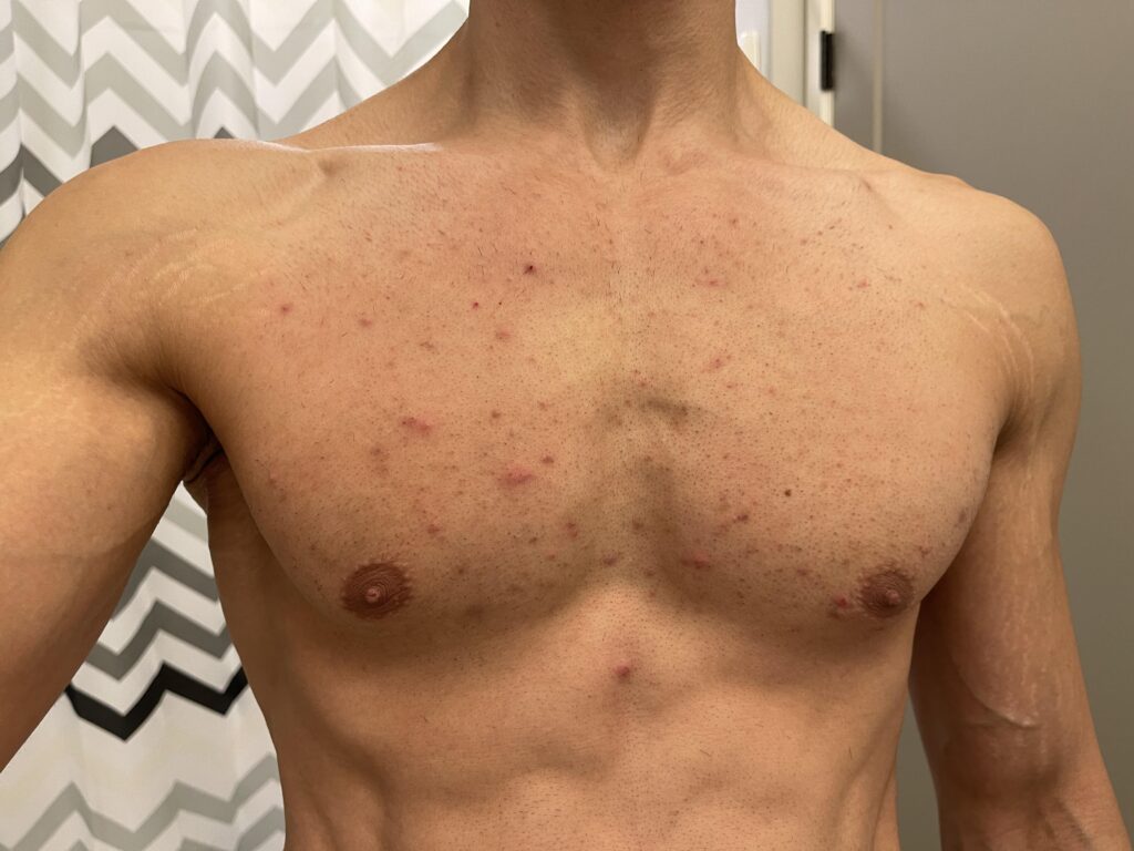  Addressing Common Concerns during Male Waxing
