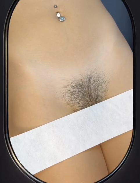 Cómo aclarar la zona del bikini