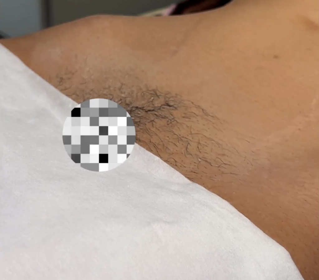 what not to do before brazilian wax